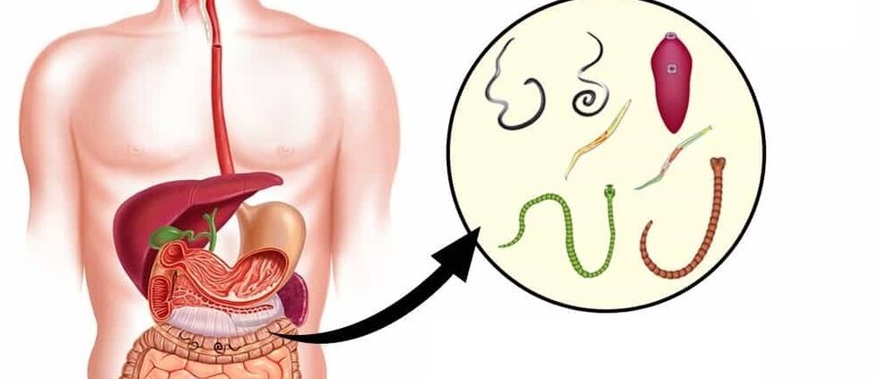 Parasites dans le corps humain.