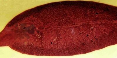 parasite trématode comment l'éliminer du corps