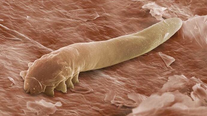 Parasite sous-cutané au microscope.